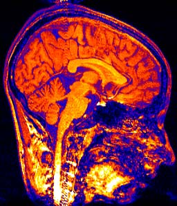 brain.jpg